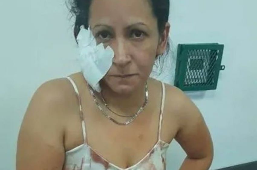 Un hombre le arrancó parte de una oreja a su pareja en Avellaneda